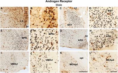 Sex differences in the coexpression of prokineticin receptor 2 and gonadal steroids receptors in mice